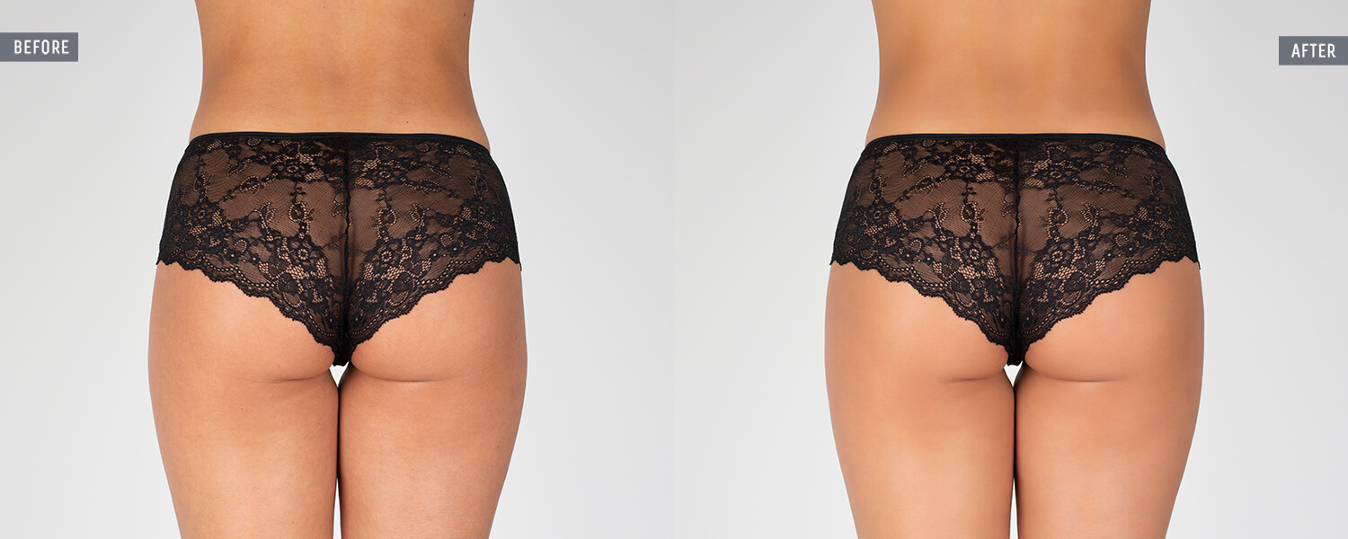 photo retouching underwear
