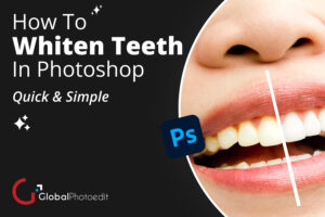 Best Teeth Whitening Photo Editor Services